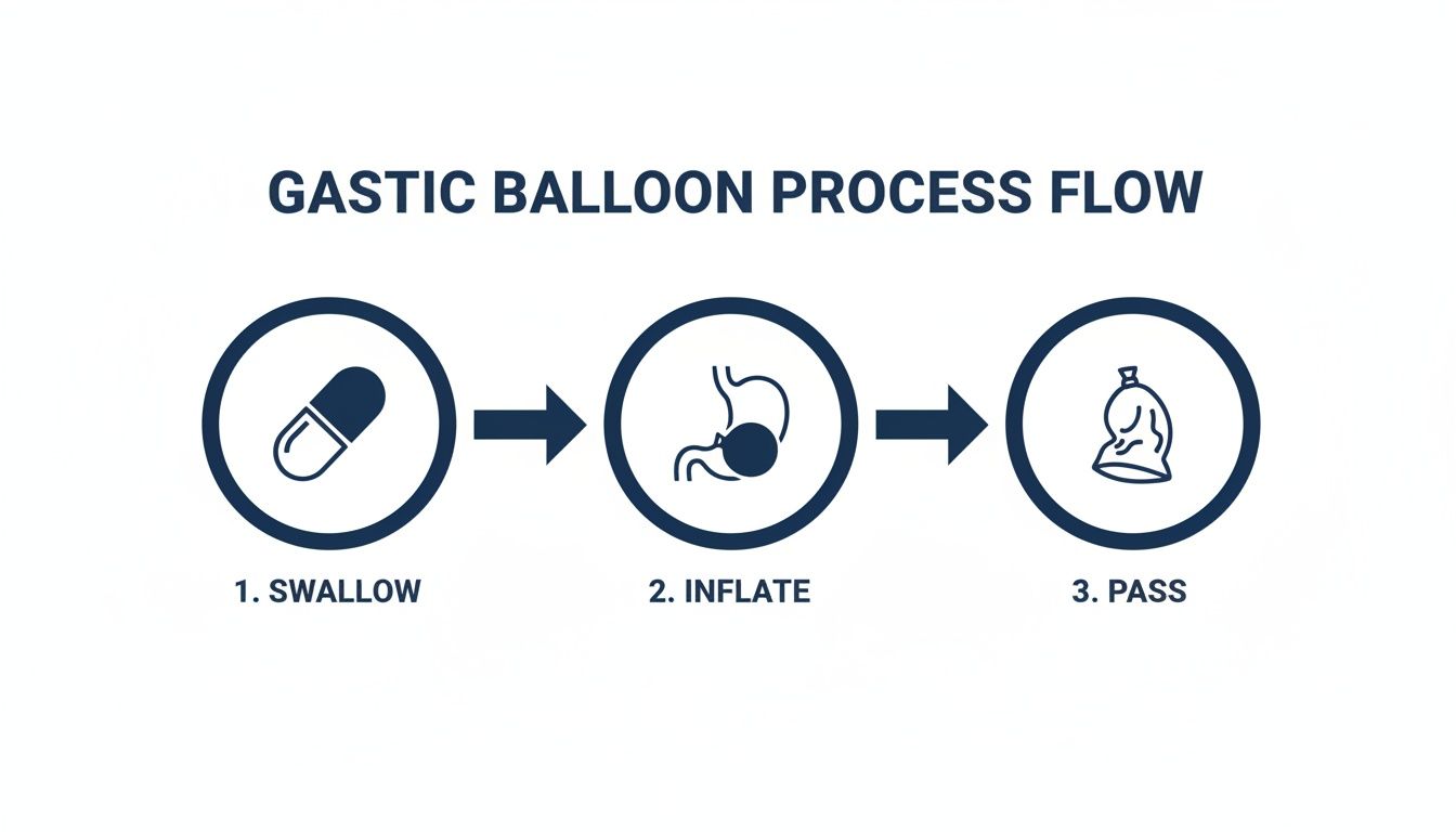 Gastric Balloon Pill: A Doctor's Guide to This Non-Surgical Weight Loss Solution 2 A three-step infographic illustrating the gastric balloon process: swallow, inflate in stomach, and pass.